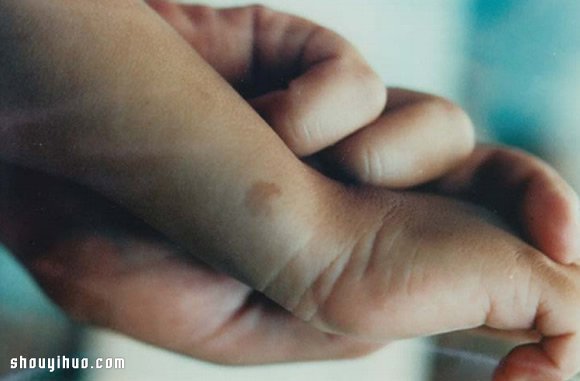 保有前世回憶胎記 7個(gè)輪回轉(zhuǎn)世故事 -  rpnrmr.com