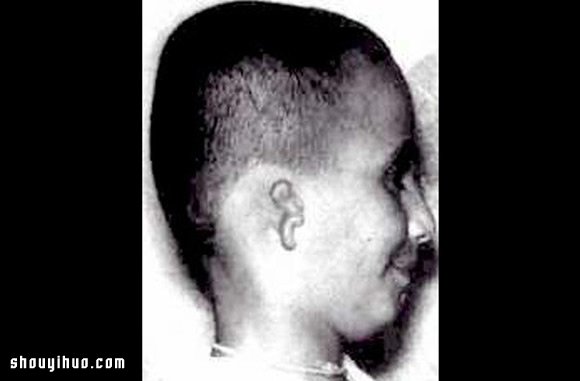 保有前世回憶胎記 7個(gè)輪回轉(zhuǎn)世故事 -  rpnrmr.com